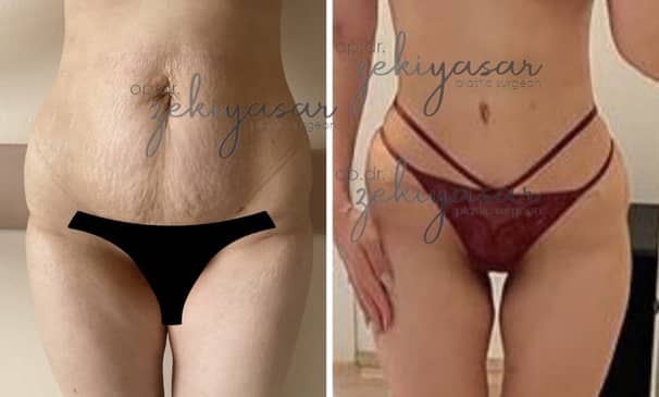 Slider image (5) Dr. Zeki Yasar Clinic